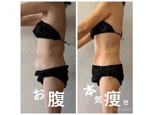アイリーボーテ 東大阪(アイリーBEAUTE)の雰囲気(60代痩身【近鉄/JR俊徳道駅/小阪/布施】)