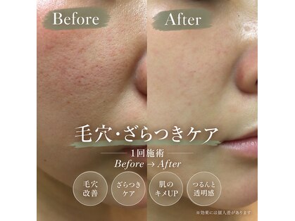 トリン 神戸 長田(Trin)の写真