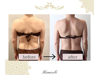 コモレビ(Komorebi)/