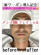 ハニーアイズ(Honey Eyes)/【BBLフェイシャル体験】