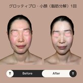 ボディケアサロン アイリフ(airef)