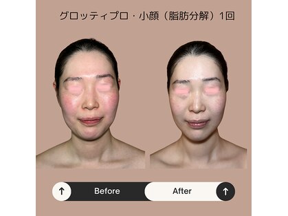 ボディケアサロン アイリフ(airef)の写真