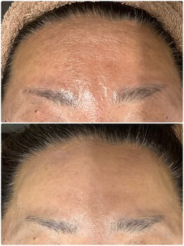 ザ ファーストサロン(The First Salon)/顔筋マッサージでおでこツルツル