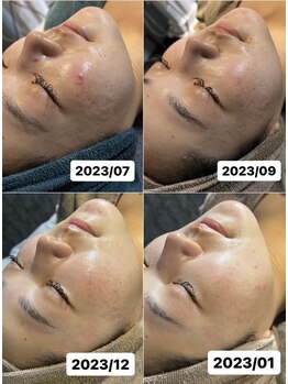 ベルーチェ(Beluce)/根本改善を目指します