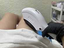 ジーワックス(G WAX)/全身脱毛1