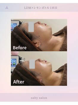 ソルティ サロン(salty salon)/★レモンボトル