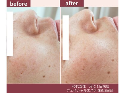 ウェルネス ステーション リンク(Wellness Station Link)の写真