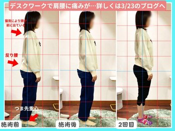 整骨院クリア 五香本院(整骨院Clear)の写真/【五香駅徒歩0分】寝ても取れないその疲れ…姿勢の悪さが原因です！ベースとなる骨盤から整え症状改善◎