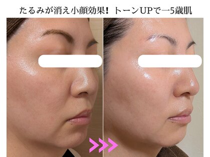 キラリ リラクゼーション(Kirary relaxation)の写真
