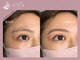キミア(KIMIA)の写真/眉が決まらない毎朝に。骨格美眉でメイクしやすく、顔印象まで自然に垢抜ける目元へ整えたい方へ☆