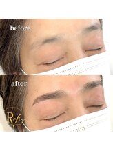 ラヴィス(RAVIS)/下がり眉を解消！