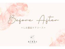 キレイ(KIREI)/ビフォーアフター