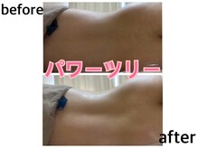 リノリー 古川店(rinory)の雰囲気（凝り・詰まり解消！！パワーツリー）