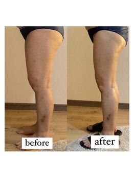 ドゥ カルム(de Calme)/