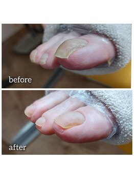 爪切り屋 足楽/