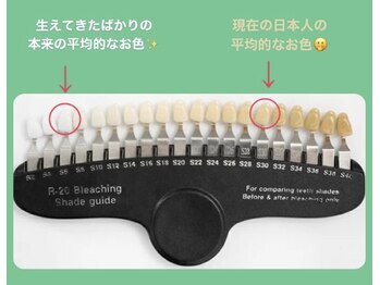 ホワイトニングバー 名古屋栄店/1.ケア前の歯のお色をチェック♪