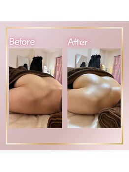 ロザリア(ROSALIA)/ふわっとバストアップ♪