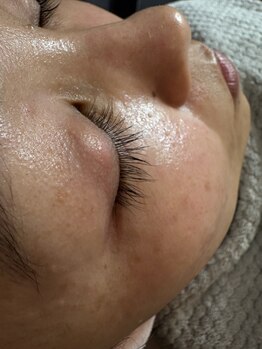 エステサロン オパール(OPALE)/ラッシュアディクト正規取り扱い