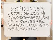 ポモナ 横浜馬車道店(Pomona)/シミケア美肌フェイシャル感想