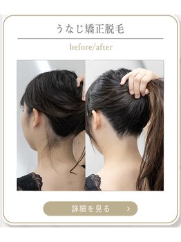 ミース 上野店/首元美人を目指す方へ