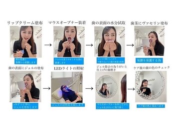 ホワイトニングショップ 船橋店/施術の流れ/ホワイトニング