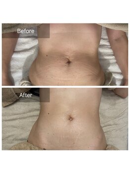 デッサン(dessin)/お腹周りの驚きの変化を!