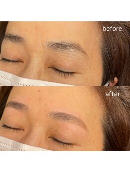 ハービンドール/【HBL】