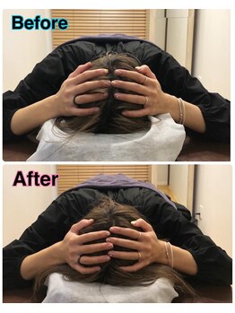 スカイ 鍼灸整骨院 整体院(SKY)/小顔矯正