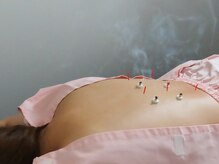 ハンドワーク(HANDWORK)/鍼灸施術