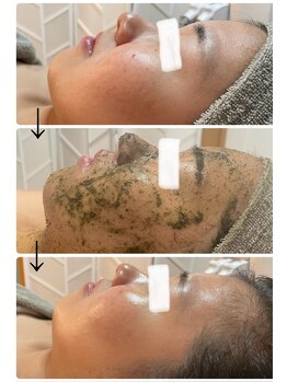 ケイサロン 朝霞店(K salon)/陶肌トリートメント