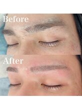 フィーノ(fino.)/メンズ脱毛