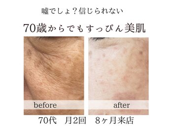 キラリ(kirari)/素敵なお客様のご感想｜肌質改善