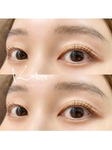 クレー(Klee)/ラッシュリフト