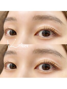 クレー(Klee)/ラッシュリフト