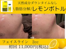 美々庵/レモンボトル/小顔/ブライダル