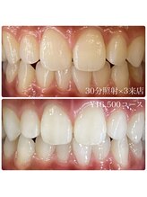 ホワイトニングルーム 横浜店(Whitening Room)/ホワイトニング/横浜