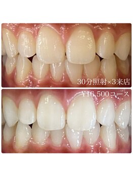 ホワイトニングルーム 横浜店(Whitening Room)/ホワイトニング/横浜