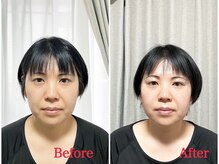 シルフィード/面長の顔が短くなりました