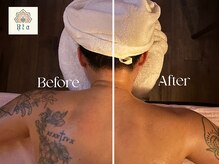 ハーバルウェルネス リタ(Herbal Wellness Rta)/リンパマッサージBefore/After