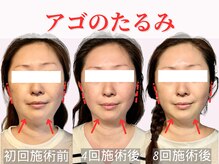 フレキシボディ(FlexiBody)の雰囲気（小顔矯正整体で中顔面のもたつき解消！すっきりした小顔へ！）