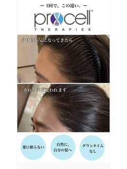 サロン ベベ(Salon Bebe)/頭皮ケア!プロセルセラピーズ