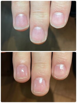 クーラ アンド ベリッシモ(Cura&Bellissimo)/自爪育成・ネイルケア