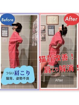 ナオル整体 西川口院(NAORU整体)/ 後屈のチェック♪　柔軟性up