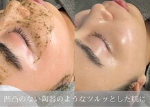 ムーンサン(Moon sun)