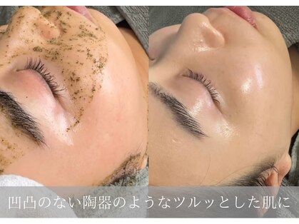 ムーンサン(Moon sun)の写真