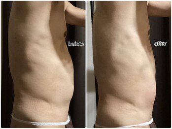 ヴィー(VII)/お腹周り集中メンズ痩身