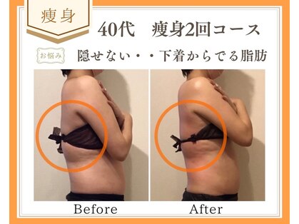 リュミエール(Lumiere)の写真