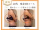 リュミエール(Lumiere)の写真