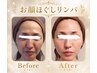 プレミアム限定ケア