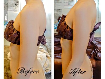 フロレゾン(Floraison)/痩身・筋膜ケア